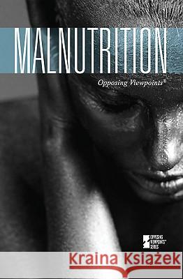 Malnutrition Margaret Haerens 9780737743838 Cengage Gale - książka
