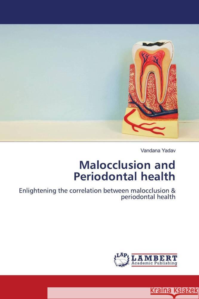 Malocclusion and Periodontal health Yadav, Vandana 9786205500965 LAP Lambert Academic Publishing - książka