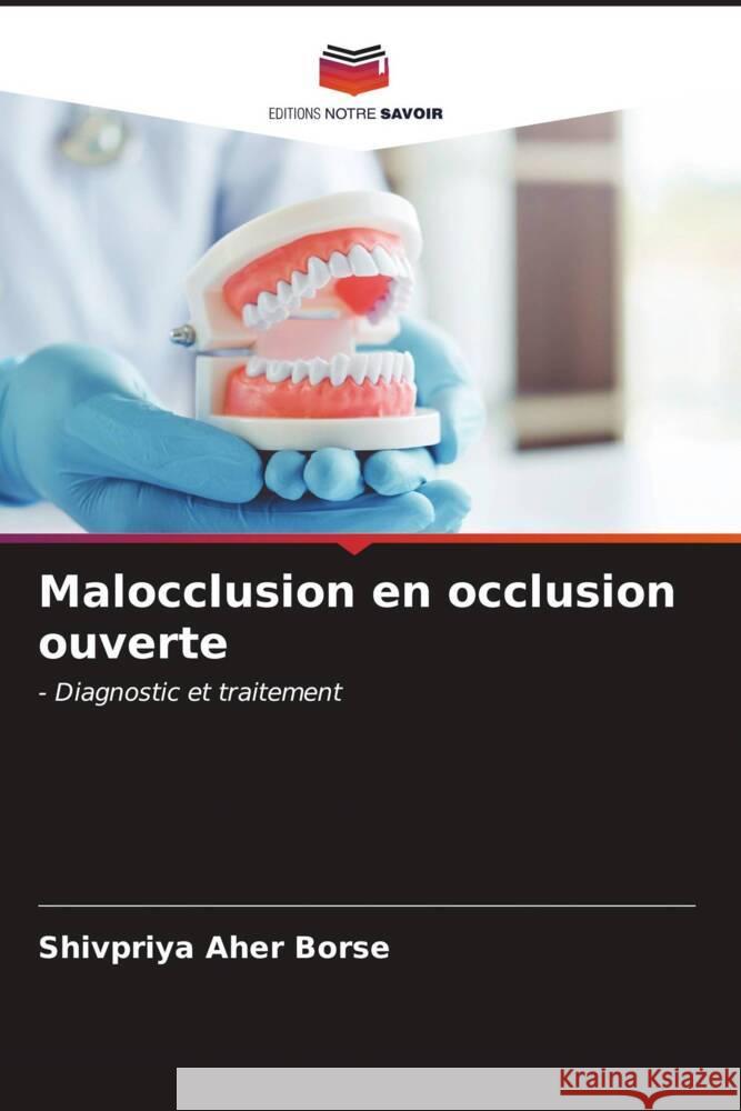 Malocclusion en occlusion ouverte Aher Borse, Shivpriya 9786206534594 Editions Notre Savoir - książka