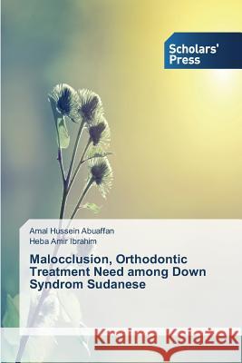 Malocclusion, Orthodontic Treatment Need among Down Syndrom Sudanese Abuaffan Amal Hussein                    Amir Ibrahim Heba 9783639715965 Scholars' Press - książka