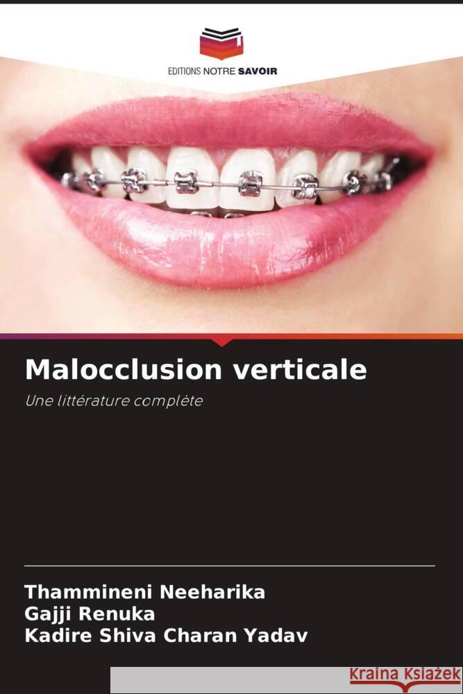 Malocclusion verticale Neeharika, Thammineni, Renuka, Gajji, Shiva Charan Yadav, Kadire 9786206475996 Editions Notre Savoir - książka