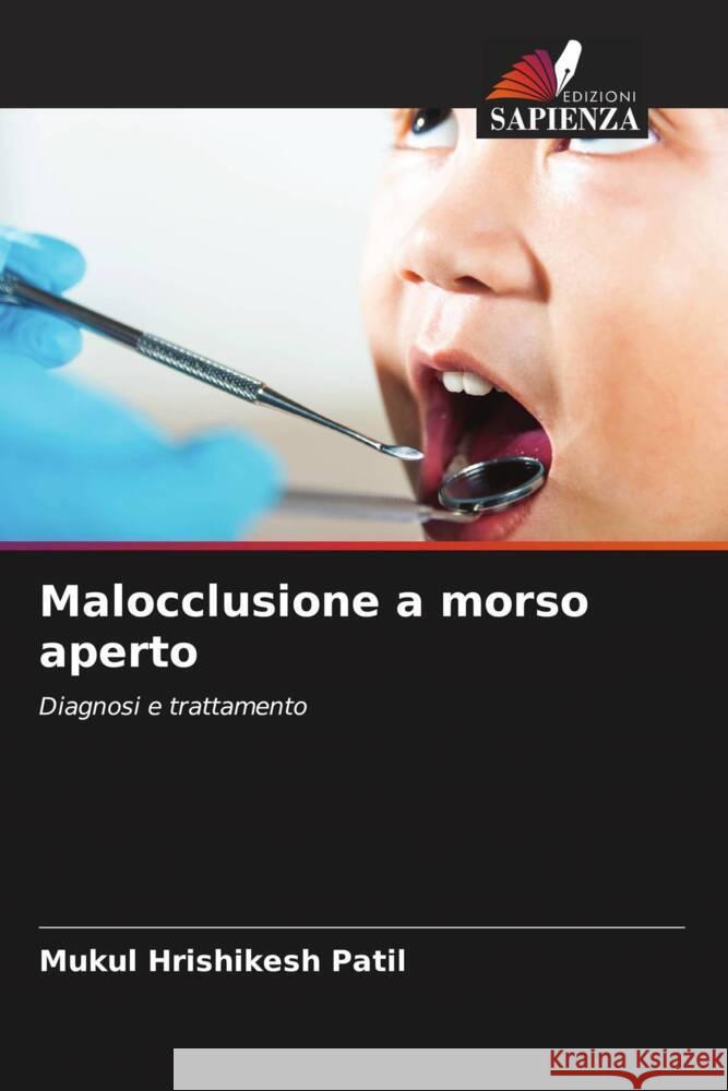 Malocclusione a morso aperto Patil, Mukul Hrishikesh 9786206432920 Edizioni Sapienza - książka