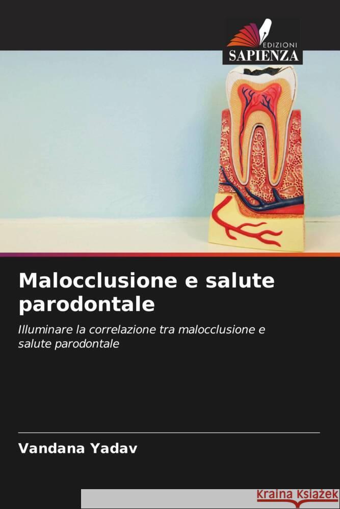 Malocclusione e salute parodontale Yadav, Vandana 9786205253168 Edizioni Sapienza - książka