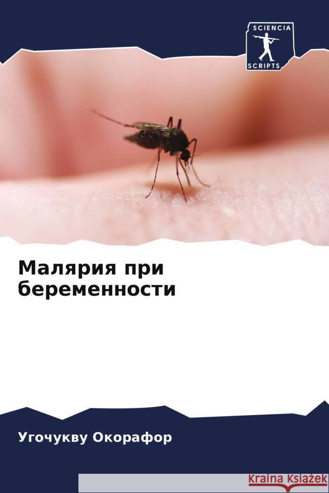 Malqriq pri beremennosti Okorafor, Ugochukwu 9786205098004 Sciencia Scripts - książka