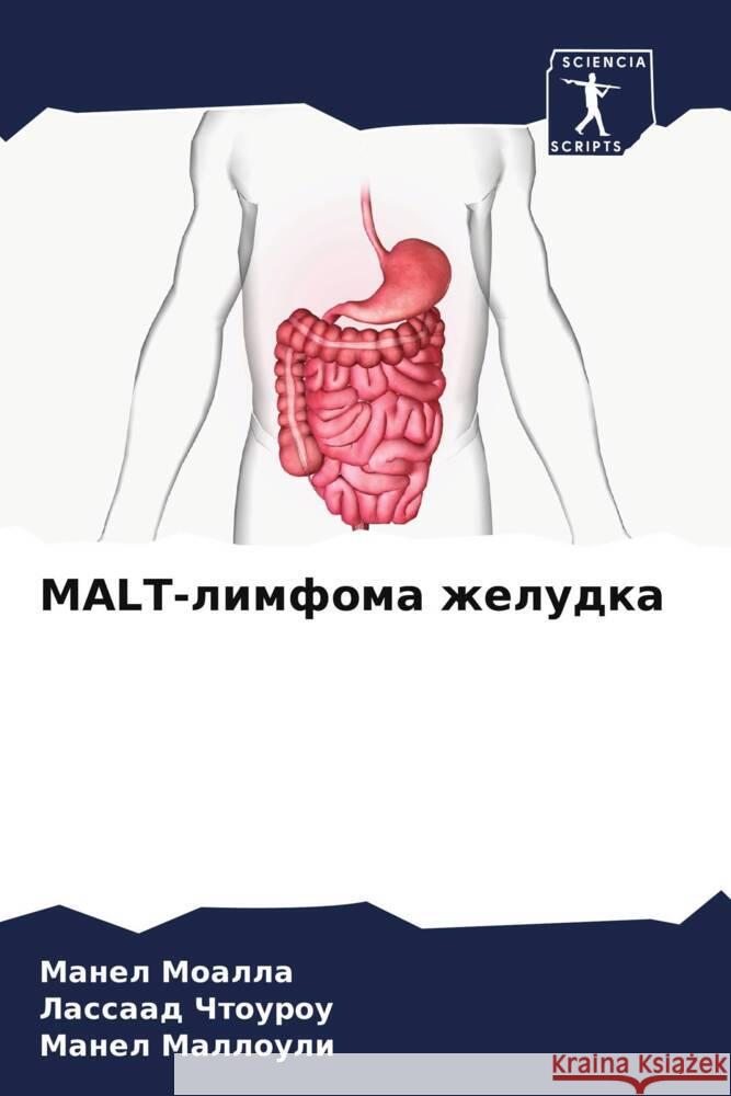 MALT-limfoma zheludka MOALLA, Manel, Chtourou, Lassaad, Mallouli, Manel 9786206258704 Sciencia Scripts - książka