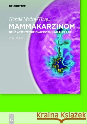 Mammakarzinom: Neue Aspekte Zur Diagnostik Und Therapie Meden, Harald 9783110408713 De Gruyter - książka