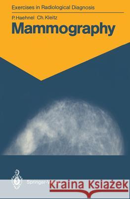 Mammography: 83 Radiological Exercises for Students and Practitioners Lux, Bernadette 9783540153283 Springer - książka