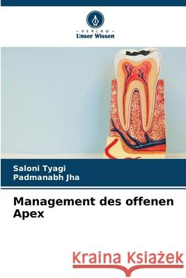 Management des offenen Apex Saloni Tyagi Padmanabh Jha 9786207673315 Verlag Unser Wissen - książka