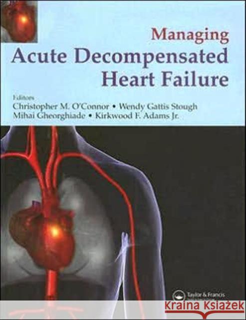 Management of Acute Decompensated Heart Failure Christopher M. O'Connor Miahai Gheorghiade Wendy Gattis Stough 9781841843742 Taylor & Francis Group - książka