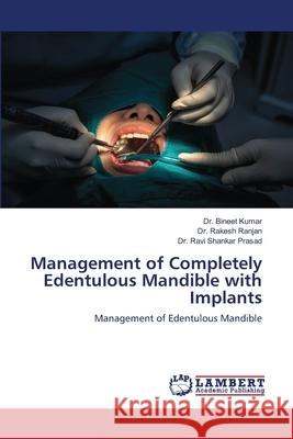 Management of Completely Edentulous Mandible with Implants Bineet Kumar Rakesh Ranjan Ravi Shankar Prasad 9786203304626 LAP Lambert Academic Publishing - książka