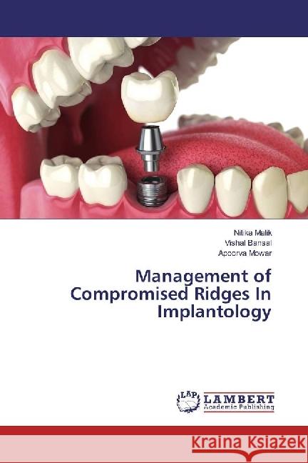 Management of Compromised Ridges In Implantology Malik, Nitika; Bansal, Vishal; Mowar, Apoorva 9786202003827 LAP Lambert Academic Publishing - książka