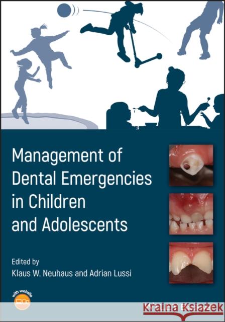 Management of Dental Emergencies in Children and Adolescents Klaus W. Neuhaus Adrian Lussi 9781119372646 Wiley-Blackwell - książka