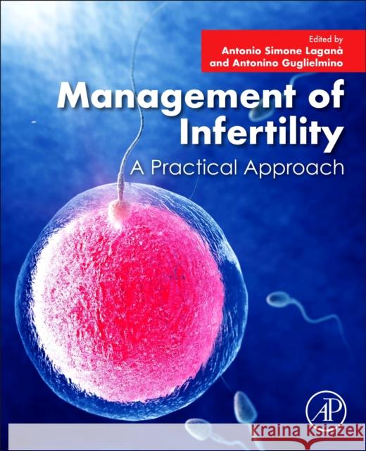 Management of Infertility: A Practical Approach Antonio Simone Lagana Antonino Guglielmino 9780323899079 Academic Press - książka