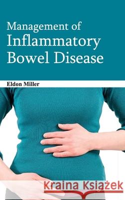 Management of Inflammatory Bowel Disease Eldon Miller 9781632422699 Foster Academics - książka