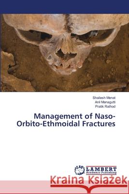 Management of Naso-Orbito-Ethmoidal Fractures Menat, Shailesh, Managutti, Anil, Rathod, Pratik 9786208425036 LAP Lambert Academic Publishing - książka
