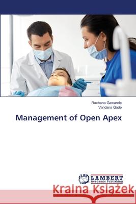 Management of Open Apex Rachana Gawande Vandana Gade 9786203201475 LAP Lambert Academic Publishing - książka