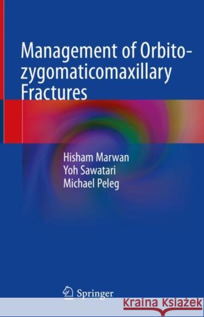 Management of Orbito-Zygomaticomaxillary Fractures Marwan, Hisham 9783030426446 Springer - książka
