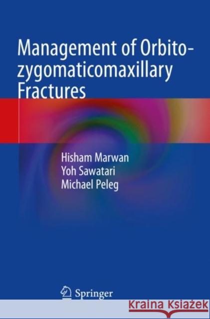 Management of Orbito-Zygomaticomaxillary Fractures Hisham Marwan Yoh Sawatari Michael Peleg 9783030426477 Springer - książka