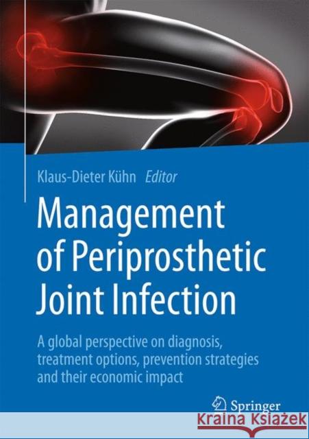 Management of Periprosthetic Joint Infection: A Global Perspective on Diagnosis, Treatment Options, Prevention Strategies and Their Economic Impact Kühn, Klaus-Dieter 9783662544686 Springer - książka