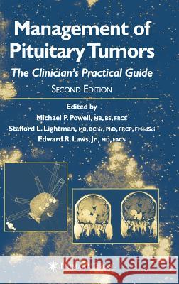 Management of Pituitary Tumors: The Clinician's Practical Guide Powell, Michael P. 9781588290533 Humana Press - książka