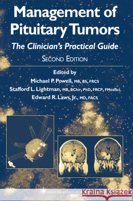 Management of Pituitary Tumors: The Clinician's Practical Guide Powell, Michael P. 9781617373275 Springer - książka