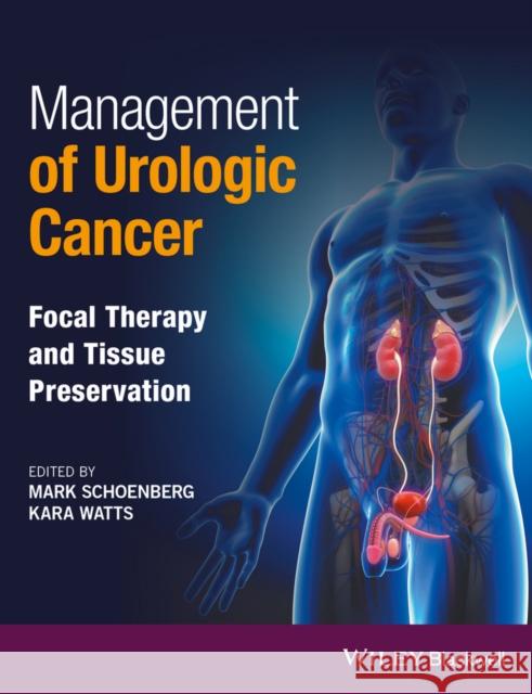 Management of Urologic Cancer: Focal Therapy and Tissue Preservation Schoenberg, Mark P. 9781118864623 John Wiley & Sons - książka