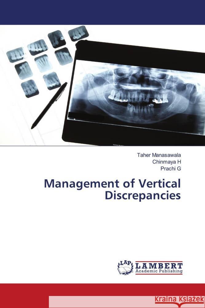 Management of Vertical Discrepancies Manasawala, Taher, H, Chinmaya, G, Prachi 9786204735771 LAP Lambert Academic Publishing - książka