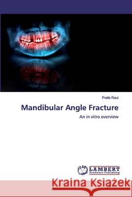 Mandibular Angle Fracture Raut, Pratik 9786139471881 LAP Lambert Academic Publishing - książka