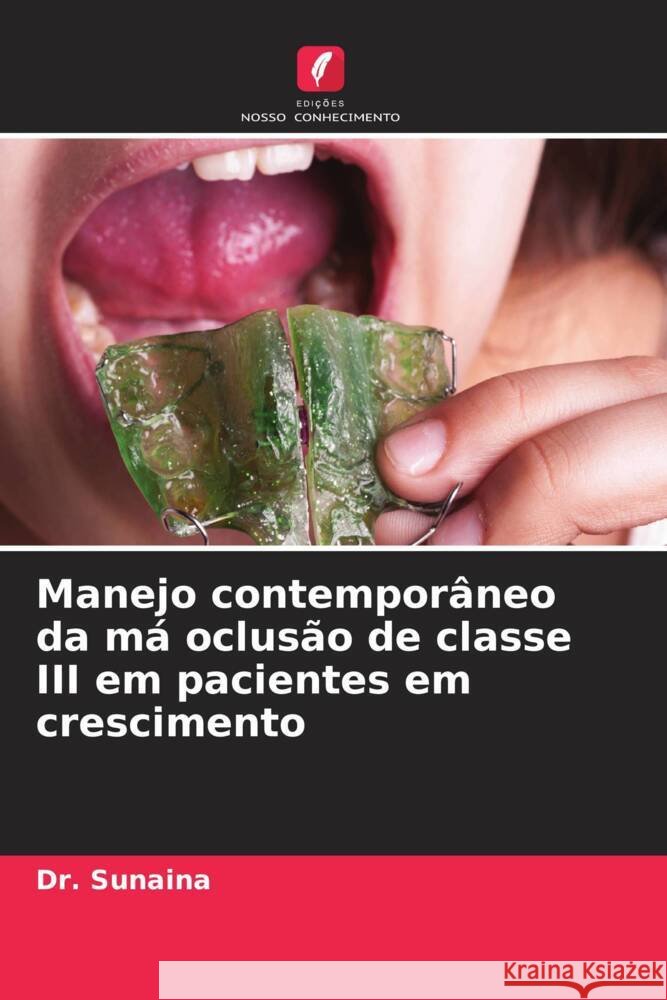 Manejo contemporâneo da má oclusão de classe III em pacientes em crescimento Sunaina, Dr. 9786208551667 Edições Nosso Conhecimento - książka