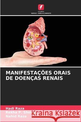 Manifestacoes Orais de Doencas Renais Hadi Raza Rekha P Shenoy Nahid Raza 9786205651254 Edicoes Nosso Conhecimento - książka