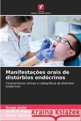 Manifestações orais de distúrbios endócrinos Joshi, Anuja, Panat, Sunil R., Agarwal, Nupur 9786209071027 Edições Nosso Conhecimento - książka