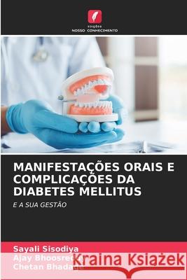 MANIFESTAÇÕES ORAIS E COMPLICAÇÕES DA DIABETES MELLITUS Sisodiya, Sayali, Bhoosreddy, Ajay, Bhadage, Chetan 9786208808679 Edições Nosso Conhecimento - książka