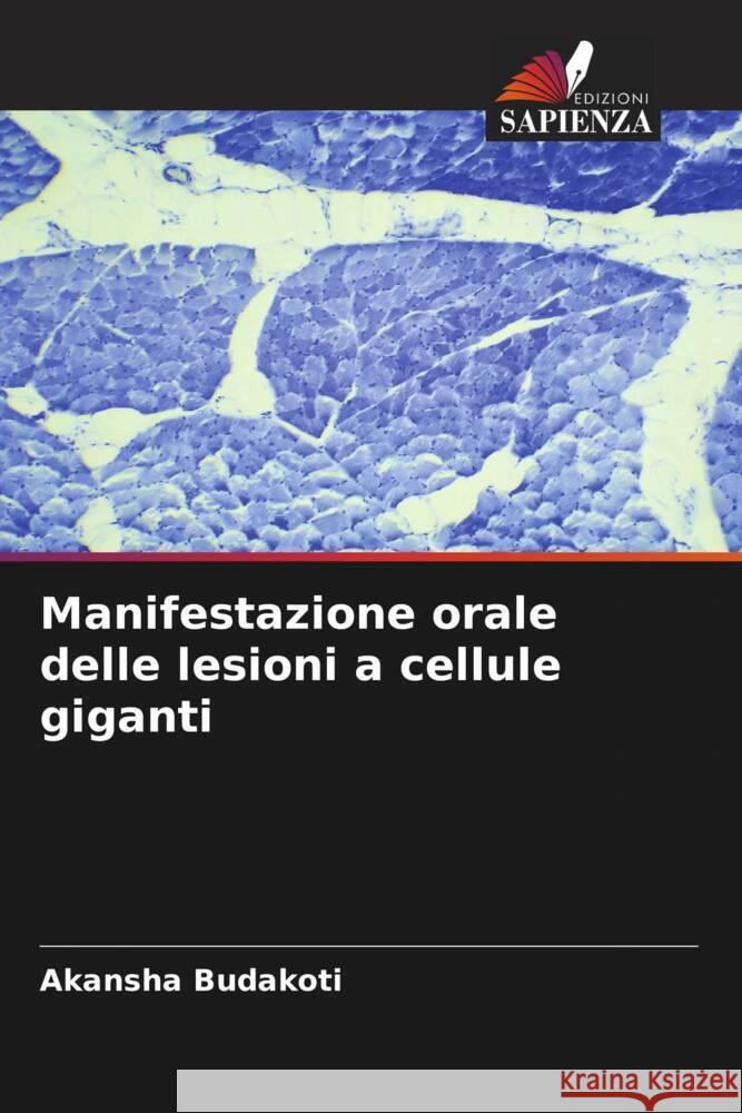 Manifestazione orale delle lesioni a cellule giganti Budakoti, Akansha 9786205059821 Edizioni Sapienza - książka