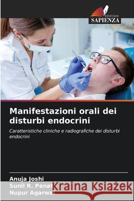 Manifestazioni orali dei disturbi endocrini Joshi, Anuja, Panat, Sunil R., Agarwal, Nupur 9786209068461 Edizioni Sapienza - książka