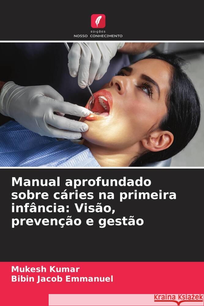 Manual aprofundado sobre c?ries na primeira inf?ncia: Vis?o, preven??o e gest?o Mukesh Kumar Bibin Jacob Emmanuel 9786207035755 Edicoes Nosso Conhecimento - książka