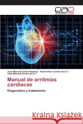 Manual de arritmias cardíacas Cortes Ramírez Juan Manuel 9783659101564 Editorial Academica Espanola - książka