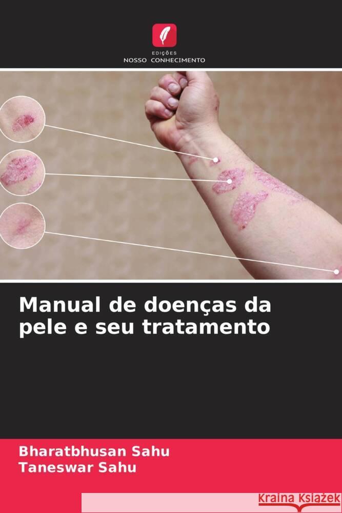 Manual de doen?as da pele e seu tratamento Bharatbhusan Sahu Taneswar Sahu 9786207372461 Edicoes Nosso Conhecimento - książka