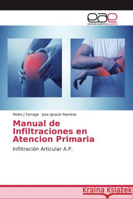 Manual de Infiltraciones en Atencion Primaria : Infiltración Articular A.P. Tarraga, Pedro J; Ramirez, Jose Ignacio 9786200058591 Editorial Académica Española - książka