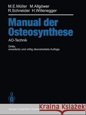 Manual Der Osteosynthese: Ao-Technik Perren, S. M. 9783642491405 Springer - książka