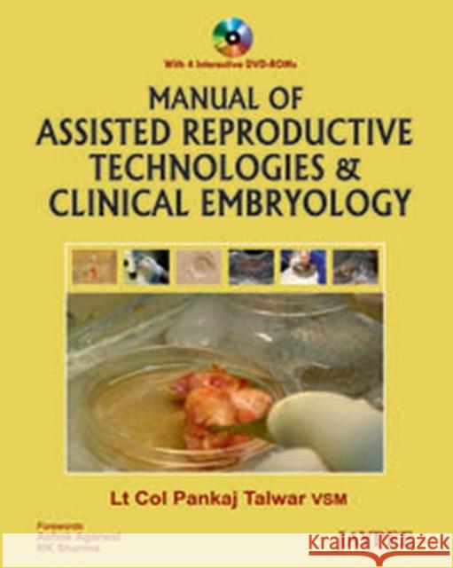 Manual of Assisted Reproductive Technologies and Clinical Embryology Pankaj Talwar   9789350255063 Jaypee Brothers Medical Publishers - książka