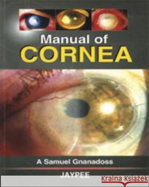 Manual of Cornea  9788184481945 Jaypee Brothers Medical Publishers - książka