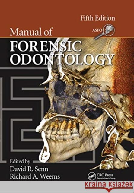 Manual of Forensic Odontology  9780367778514 Taylor and Francis - książka