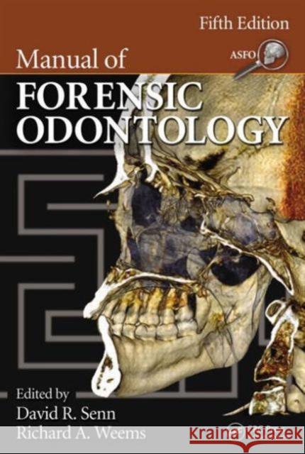 Manual of Forensic Odontology David R. Senn Richard A. Weems 9781439851333 Taylor & Francis Group - książka