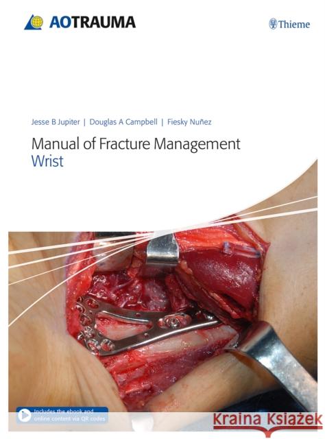 Manual of Fracture Management - Wrist Jupiter, Jesse B. 9783132428416 Thieme Medical Publishers - książka