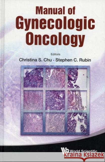 Manual of Gynecologic Oncology Rubin, Stephen C. 9789814343695 World Scientific Publishing Company - książka