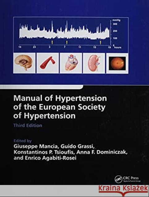 Manual of Hypertension of the European Society of Hypertension, Third Edition Giuseppe Mancia Guido Grassi Konstantinos Tsioufis 9780367778613 CRC Press - książka