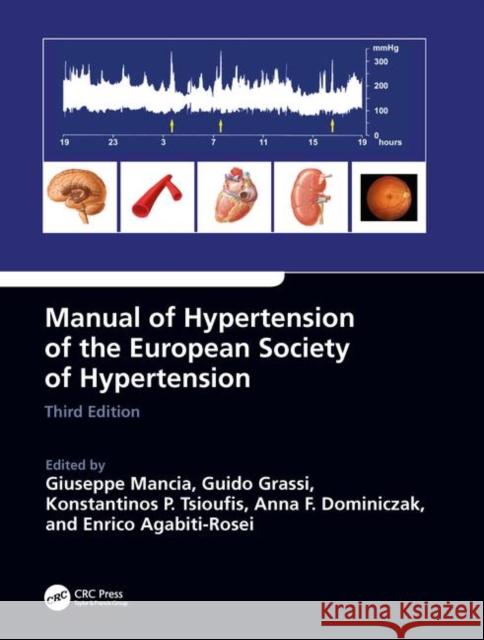 Manual of Hypertension of the European Society of Hypertension, Third Edition Giuseppe Mancia Guido Grassi Konstantinos Tsioufis 9780815378747 CRC Press - książka