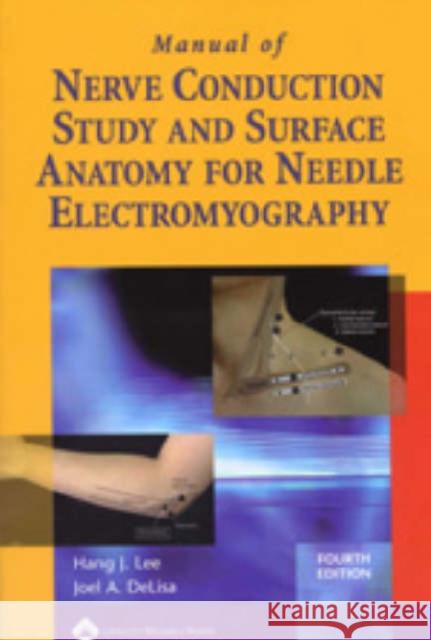 Manual of Nerve Conduction Study and Surface Anatomy for Needle Electromyography Joel A DeLisa 9780781758215 Lippincott Williams and Wilkins - książka