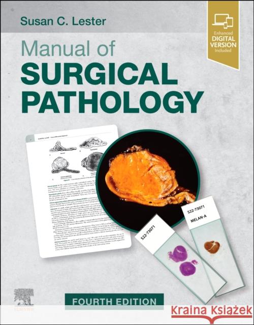 Manual of Surgical Pathology Susan C. Lester 9780323546324 Elsevier - Health Sciences Division - książka