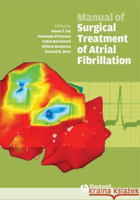 Manual of Surgical Treatment of Atrial Fibrillation Guiseppe D'Ancona Fabio Barolozzi Willem Beukema 9781405140324 Blackwell Publishers - książka